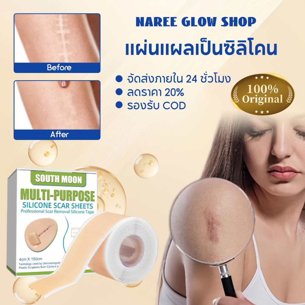 South Moon แผ่นแผลเป็นซิลิโคน Silicone Scar Sheet 4*150cm ลดรอยแผลเป็น การกำจัดรอยแผลเป็น แผลคีลอยด์