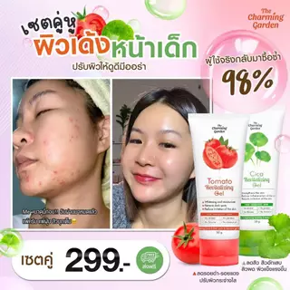 [ส่งฟรี ซื้อในไลฟ์ลด50%ของแท้]เซ็ตคู่เจลใบบัวบกและเจลมะเขือเทศ เดอะ ชาร์มมิ่ง The Charming Cica Gel