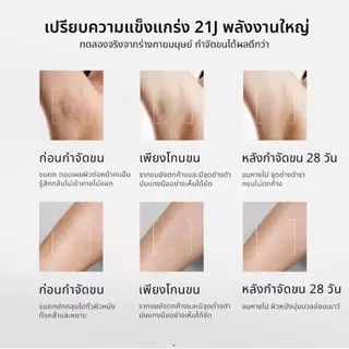 ️【รับประกัน2ปี】SiIk'n laser ขน เครื่องเลเซอร์ขนเกรดทางการแพทย์ 21J (ไม่จำกัดช็อต)Multi Function สี golden