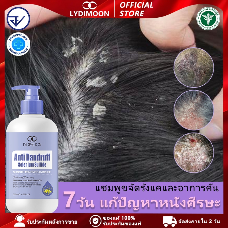 LYDIMOON แชมพูขจัดรังแค: ขจัดรังแคได้อย่างมีประสิทธิภาพ บรรเทาอาการคันหนังศีรษะ ลดความมัน และฟื้นฟูผ