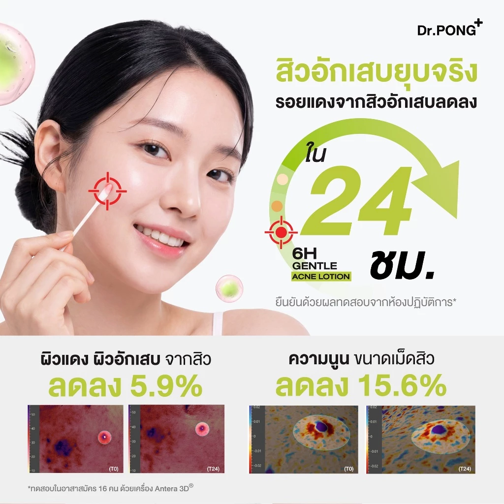 Dr.PONG 6H GENTLE ACNE LOTION แป้งน้ำแต้มสิว สิวยุบใน 1 คืน แห้งไว ไม่ทิ้งรอย ไม่ขึ้บนซ้ำ thumbnail 7
