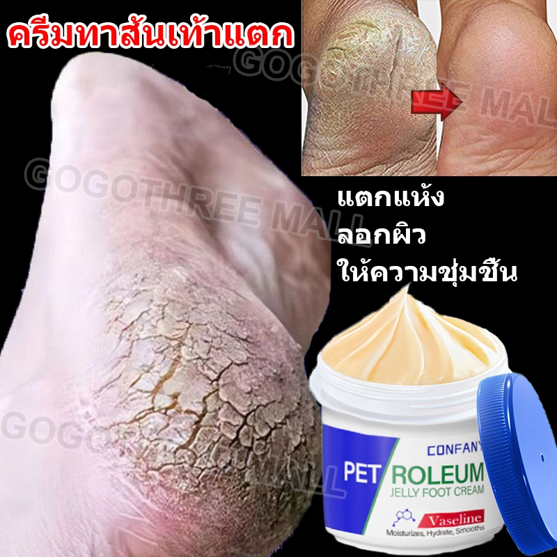 ส้นเท้าแตก ครีมทาเท้า ดเท้าแตก เท้าแตก รีมนวดเท้า ครีมเท้าแตก ยาทาเท้าแตก มือแห้งแตก
