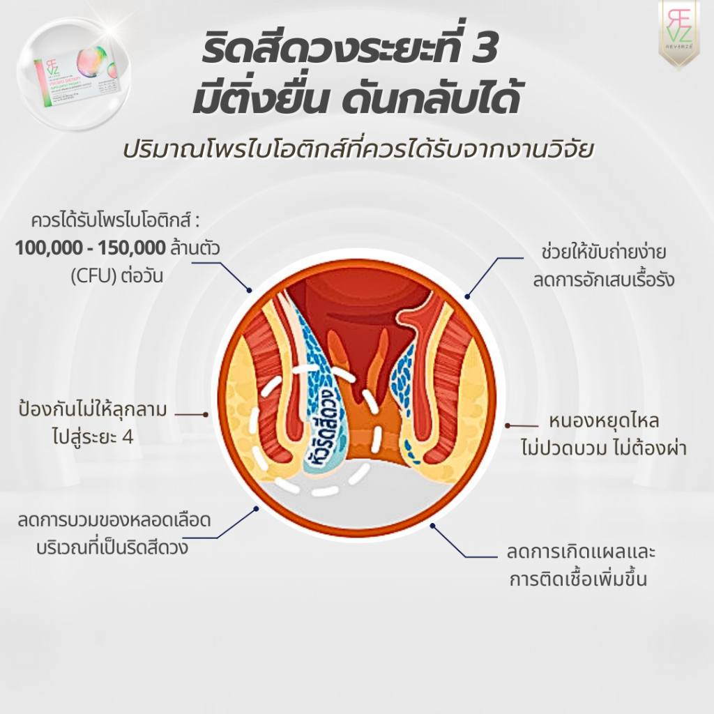 รีเวอร์เซ่ By รีเวร่า โพรไบโอติก พลัส เอลเดอร์เบอร์รี่ ผลิตและคิดสูตรโดยแพทย์นักวิจัยเยอรมนี  2กล่อง - รูปที่ 6