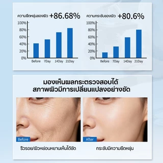 แผ่นแปะร่องแก้มต่อต้านริ้วรอย แผ่นแปะริ้วรอย ซองละ 18 แผ่น ผิวกระชับ ลดริ้วรอยลึก กับเปปไทด์เข้มข้น มาส์กหน้า