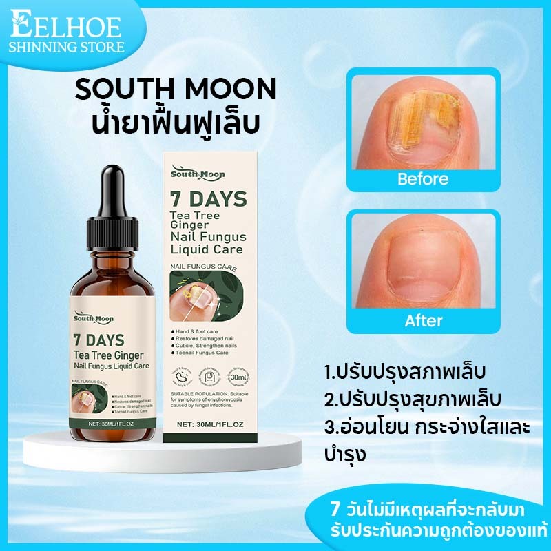 South Moon น้ำยาฟื้นฟูเล็บ ผลิตภัณฑ์ดูแลเล็บทําความสะอาดและปกป้องเล็บเสริมความแข็งแรงปกป้องเล็บเปราะ