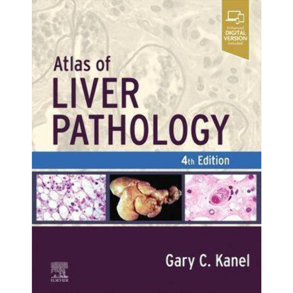 หนังสือ Atlas of Liver Pathology Ed.4/2024