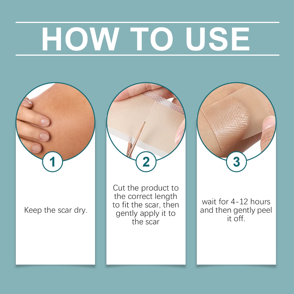 【ขายส่ง】Laniska แพทช์ดูแลผิวซิลิโคน สำหรับการใช้ประจำวัน ให้การดูแลผิวท้องและร่างกายที่ราบรื่น - รูปที่ 3