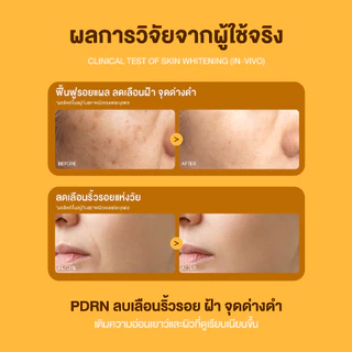 [1 แถม 1] Herbanist (formerly Herbalist) Bounce & Glow Youth Serum เฮอบานิสท์ เซรั่มผิวเด้งปรับผิวให้แลดูกระจ่างใส 30 ml