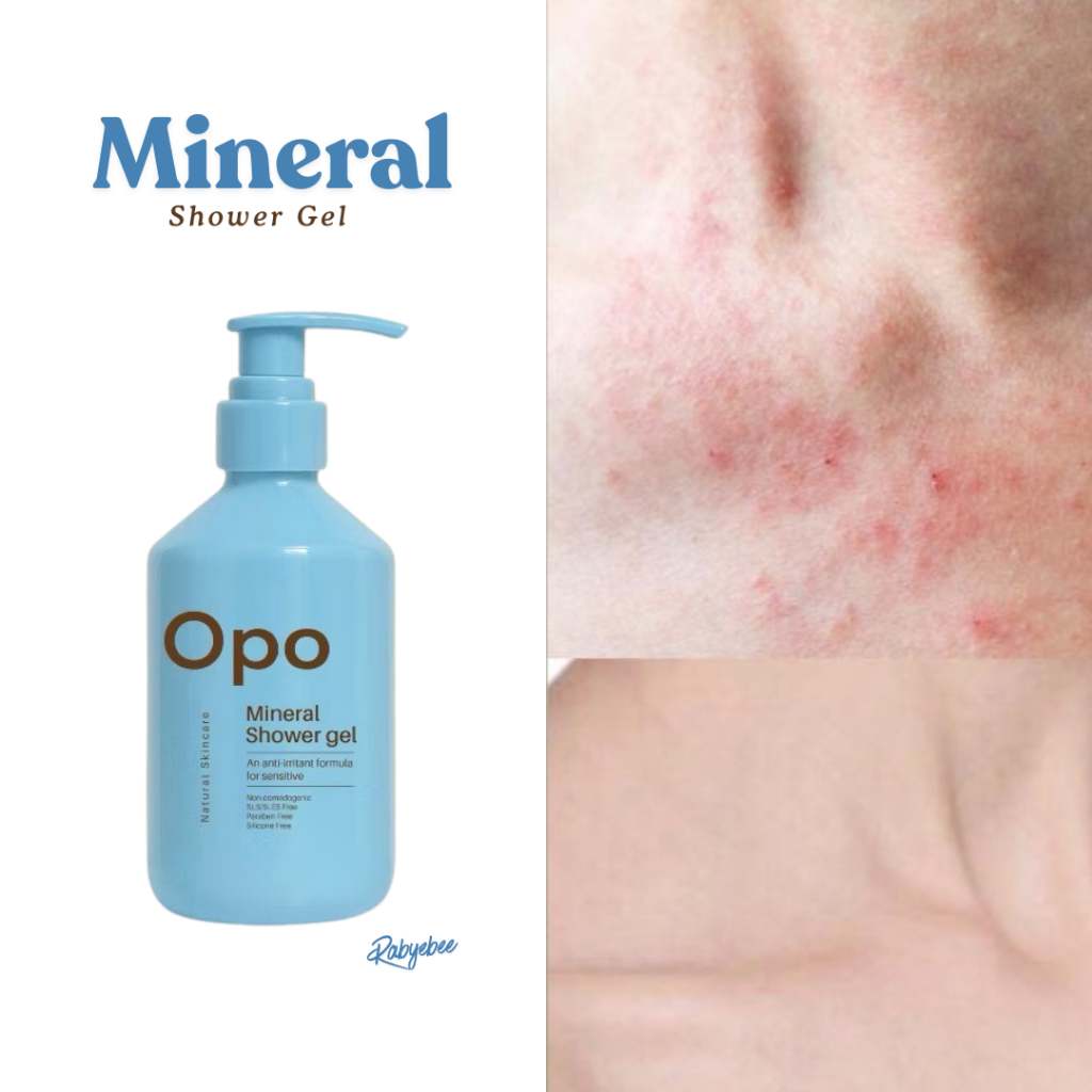 OPO | Rabye Mineral​ Shower สบู่เหลวน้ำแร่ ลดผดผื่นคัน​ ผิวอักเสบแดง แพ้ง่าย​ น้ำเหลืองไม่ดี