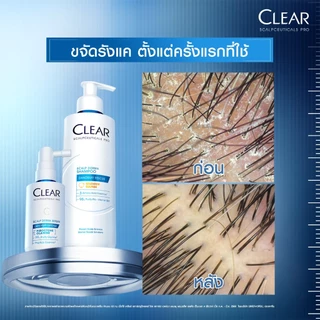 [เคลียร์พรีเมี่ยม][เซ็ท2ขั้นตอน] เคลียร์ สกาล์ปซูติคอลส์ โปร แชมพู + เซรั่มบำรุงและขจัดรังแค 200มล.+50มล.x1