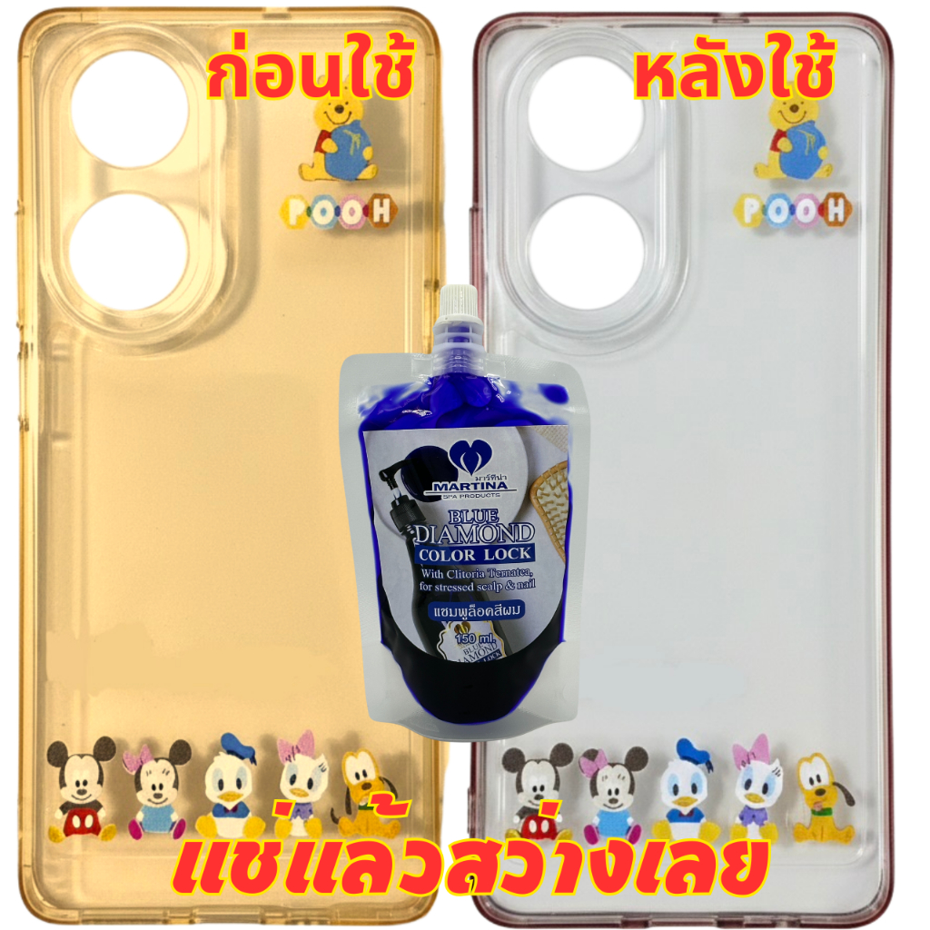 น้ำยาล้างเคสเหลือง ให้กลับมาสวยใส MARTINA 150ml.