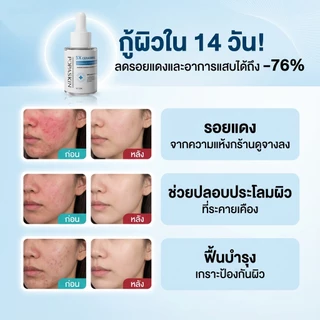 POPASKIN 5X Ceramide Barrier Hydrating Serum เซรั่มให้ความชุ่มชื้น ผิวอิ่มน้ำ ซ่อมแซมผิว ผิวอิ่มน้ำ เซรั่มผิวแพ้ง่าย30ML