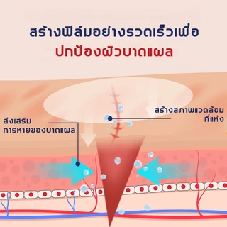 ปิดแผลชนิดน้ำ สเปรย์เคลือบแผลแบบน้ำ ปกป้องผิว สร้างฟิล์มบาง ใช้ง่ายและแห้งเร็ว พลาสเตอร์ปิดแผลชนิดเหลว