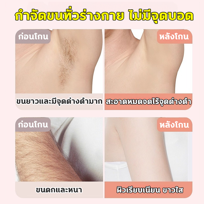 หัวโกน 2in1 เครื่องกำจัดขนสตรี กระจกในตัว จอLCD ไฟฟ้า ที่โกนขน ที่กันคิ้ว กำจัดขนง่าย เช่น รักแร้ บิกินี่ ขาหนีบ อื่นๆ ราคา ถูกที่สุด ดีลบีเคเค แกลเลอรีภาพที่ 6