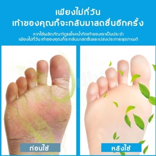 ครีมทาเท้าต้านอาการคันและเชื้อรา ควบคุมกลิ่นเท้าได้อย่างมีประสิทธิภาพ บรรเทาอาการคัน ป้องกันกลิ่น และเหมาะสำหรับเท้าเหม็