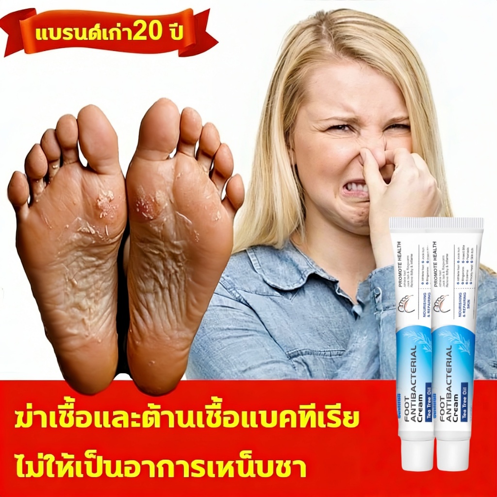 ครีมทาเท้าต้านเชื้อแบคทีเรียและดับกลิ่น คุณภาพรับประกัน ครีมรักษาโรคเท้าของนักกีฬา ครีมดับกลิ่นเท้า บรรเทาอาการคันและลดก
