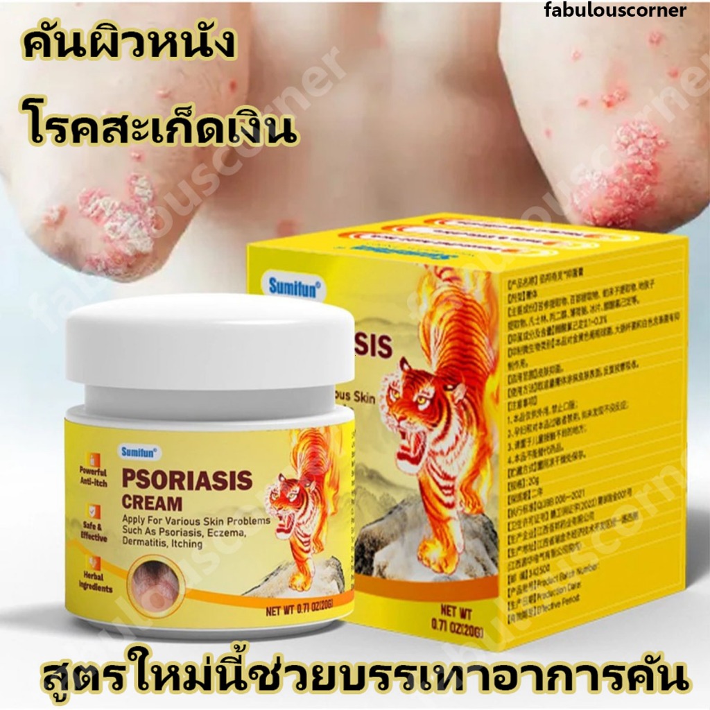 ครีมทาสังคัง สะเก็ดเงินครีม ครีมบำรุงผิว รอยแดง โรคผิวหนัง เกลื้อน กลาก คัน สมุนไพร แก้คันเรื้อรัง คันในร่มผ้า คันในร่มผ
