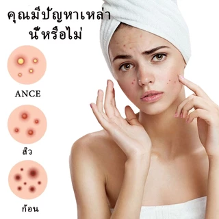 【ซื้อ 4 แถม 1】แปะสิว แปะตราสิว ดูดหนอง สามารถแต่งหน้า หยอกล้อคอนซีลเลอร์ปัดสิวได้ แผ่นแปะสิวดูดหนอง