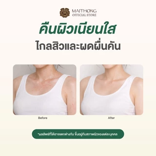 [เซ็ตสุดคุ้ม แพ็ค3] Maithong ไหมทอง สบู่สมุนไพรขัดผิวขาว สูตร Awakening (สีเขียว) 100g สบู่ขัดขี้ไคล ลดสิวที่หลัง ลดผดผื