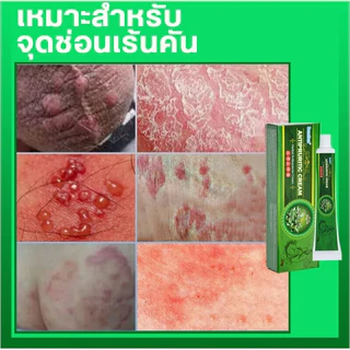 ครีมแก้คันผิว ลดผื่นคัน บรรเทาอาการคัน ฆ่าเชื้อรา ฟื้นฟูผิว เห็นผลไว 20G