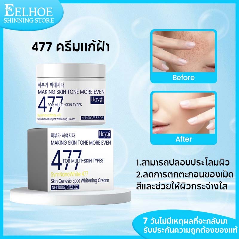 Hoygi 477 ครีมแก้ฝ้า ครีมกำจัดฝ้ากระ ลดเลือนจุดด่างดำ กระ ฝ้า เติมความชุ่มชื้นลึกถึงผิว 100g