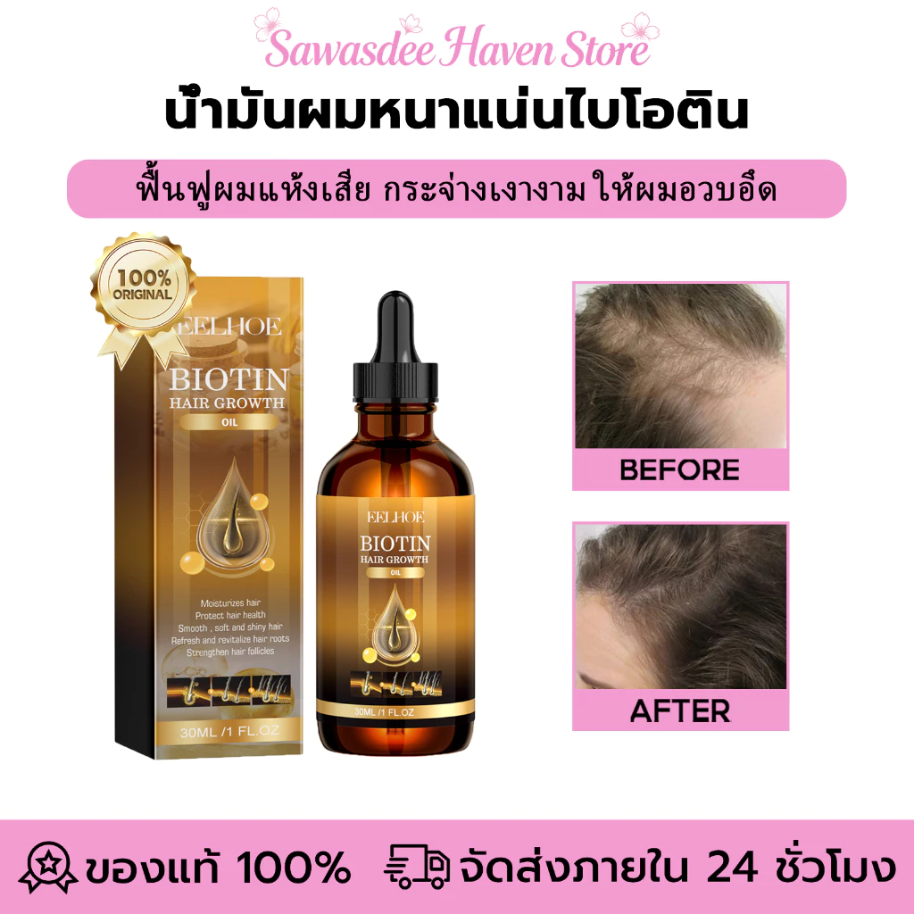 EELHOE น้ํามันผมหนาแน่นไบโอติน เซรั่มผมหนา น้ำมันปลูกผมไบโอติน เซรั่มปลูกผม บํารุงรากผม