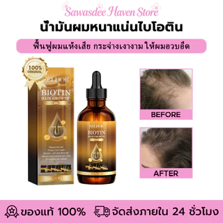 EELHOE น้ํามันผมหนาแน่นไบโอติน เซรั่มผมหนา น้ำมันปลูกผมไบโอติน เซรั่มปลูกผม บํารุงรากผม