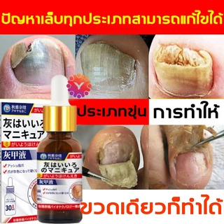 เห็นผลภายใน7วัน🔥เซรั่มบำรุงเล็บ ครีมซ่อมเล็บ ช่วยให้เล็บกลับมาแข็งแรง ครีมบำรุงเล็บ ยาเชื้อราเล็บ เซรั่มรักษาเล็บ 30ml