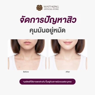 [เซ็ตสุดคุ้ม แพ็ค3] Maithong ไหมทอง สบู่มังคุด 100g คุมมัน ลดสาเหตุการเกิดสิว ฝ้า กระ จุดด่างดำ ผิวเนียนนุ่ม