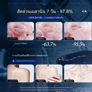 SKAT ผิวขาวสบู่เหลว ใช้ไป 3 วันก็ขาวใส กำจัดสิวบนผิว ผิวเรียบเนียนขึ้น ซ่อมแซมผิวครีมอาบน้ํา shower gel สบู่