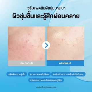 [Special Set] Torriden Dive In Multi Pad (80ea) + Dive In Mask (10ea) - ทอร์ริเดน ไฮยาลูโรนิก ผิวฟู ผิวโกลว์