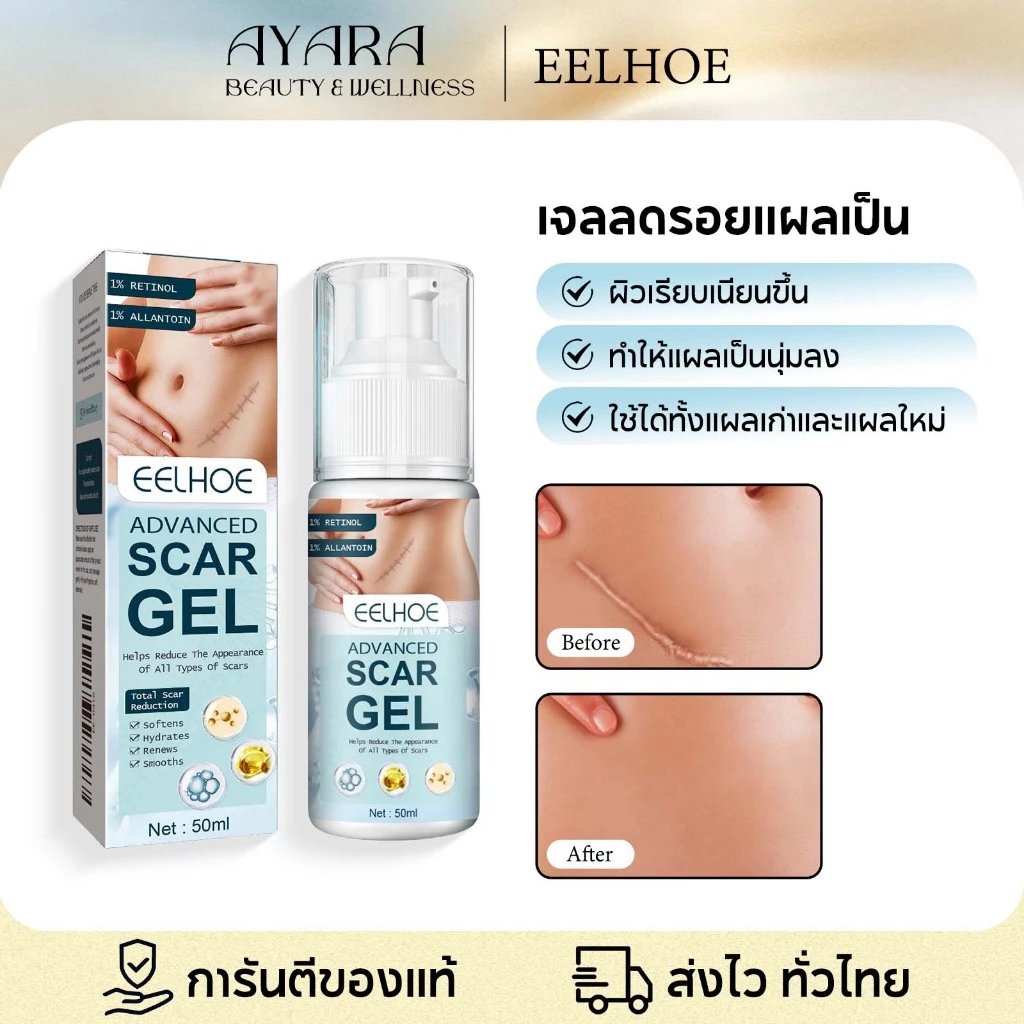 EELHOE ครีมทาแผลเป็น เจลลดรอยแผลเป็น ลบรอยแผลเป็น เจลซ่อมแซมรอยแผลเป็นทั้งรอยแผลเป็นเก่าและใหม่