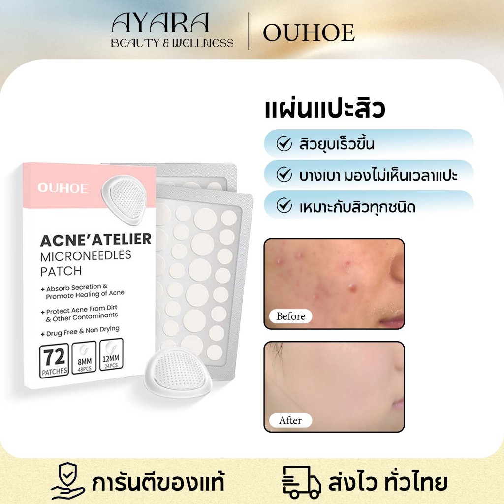 OUHOE แผ่นแปะสิวหัวเข็ม72 แผ่นแปะสิวไมโครดอท แผ่นแปะสิวไฮโดรคอลลอยด์ กันน้ำและมองไม่เห็น ช่วยลดอาการอักเสบให้สิวยุบไว