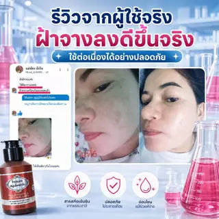 โทนเนอร์เช็ดฝ้า วิตามินสมุนไพร เช็ดฝ้ากระ ผิวกระจ่างใส