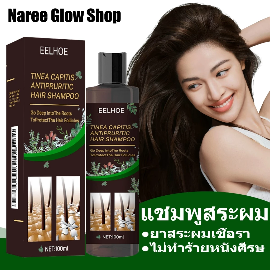 EELHOE แชมพูขจัดรังแค ยาสระผมเชื้อรา ป้องกันรังแคและคัน ไม่ทำร้ายหนังศีรษ แชมพูขจัดรังแค ลดอาการคันศีรษะ ลดรังแค