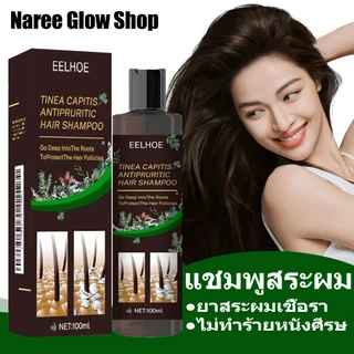 EELHOE แชมพูขจัดรังแค ยาสระผมเชื้อรา ป้องกันรังแคและคัน ไม่ทำร้ายหนังศีรษ แชมพูขจัดรังแค ลดอาการคันศีรษะ ลดรังแค