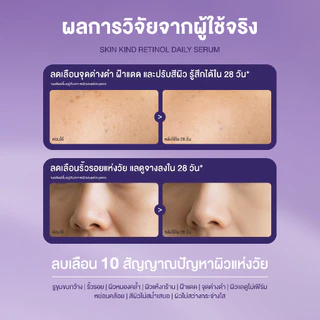 [1แถม1] Herbanist (formerly Herbalist) Skin Kind Retinol Daily Serum - เรตินอลที่อ่อนโยนที่สุด HPR1%