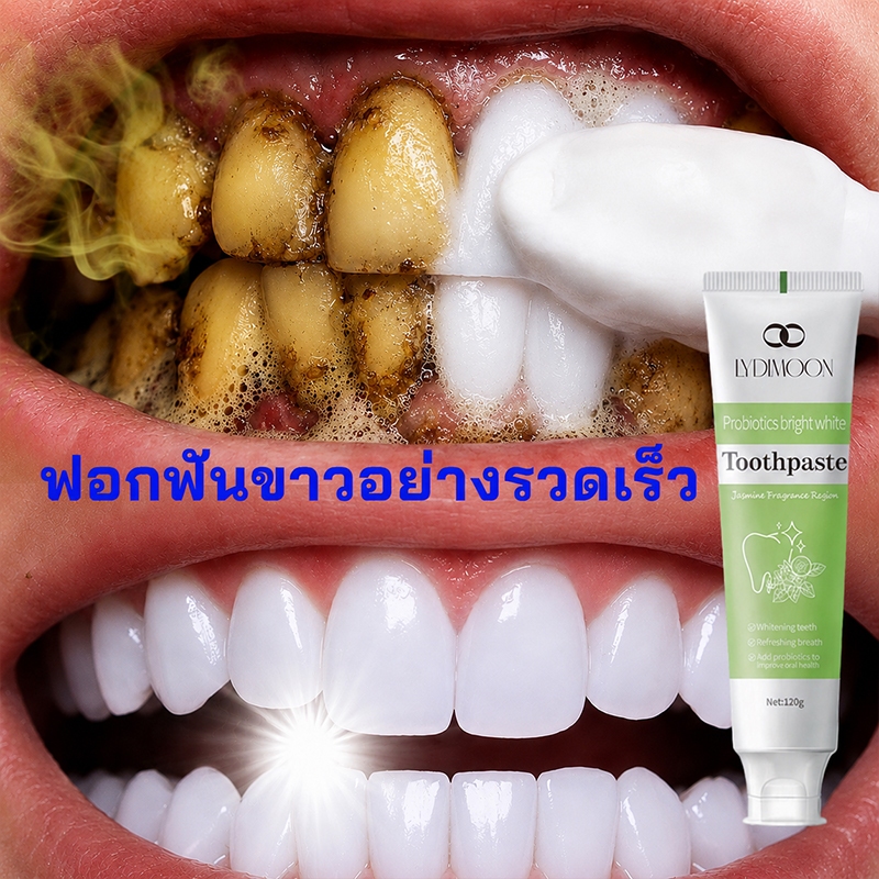ยาสีฟันขาว ยาสีฟันฟอกฟันขาว ยาสีฟันโปรไบโอติก สารสกัดจากพืช ฟอกฟันขาว ขจัดคราบเหลือง ขจัดคราบหินปูน ฆ่าเชื้อแบคทีเรีย