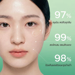 POPASKIN 2% BHA＋ MA Acne & Spots Treatment Serum เซรั่มลดสิว ลดรอยสิว คุมมัน ลดสิวอุดตัน ลดการอักเสบ 30ML