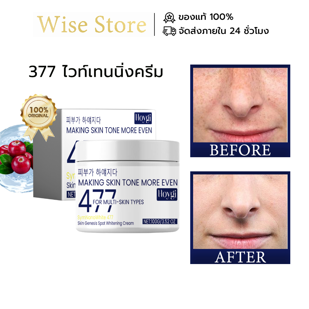 Hoygi 477 ครีมทาหน้า ไวท์เทนนิ่งครีม มอยเจอร์ไรเซอร์ ไบรท์เทนนิ่ง ดาร์ก สปอต จุดด่างดำแลจางลง ให้ควา