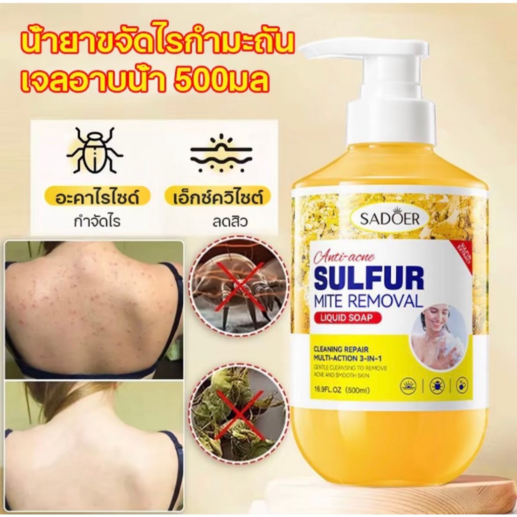 SADOER แชมพูอาบน้ำซัลเฟอร์ กำจัดไรฝุ่น ลดสิว ผิวไม่คัน สะอาดล้ำลึก 500ml ใช้ได้ทั้งตัว