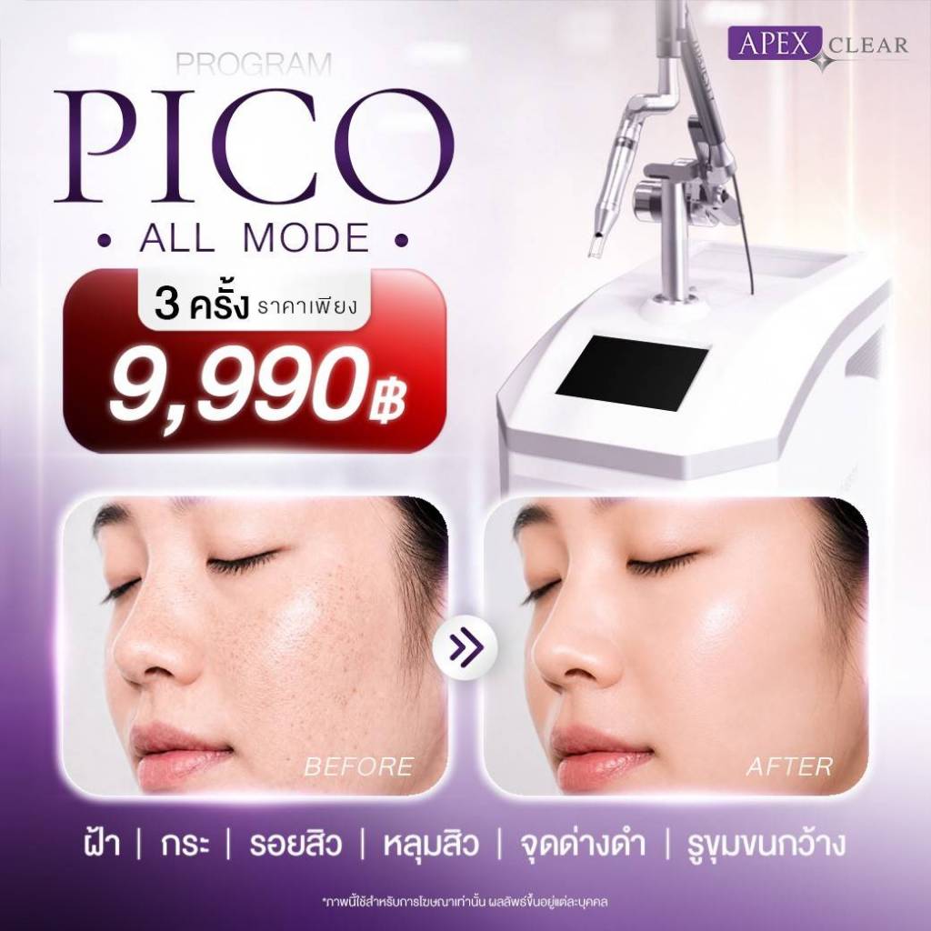พิเศษหารเพื่อนได้ [E-Voucher] APEX Pico all mode 3ครั้ง 9,990 ปกติ 20,000 ครอบคลุมทุกปัญหาผิวหน้า 1ท