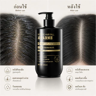 แชมพูขิง ลดผมร่วง บำรุงรากผม เร่งผมยาว ผมแข็งแรง