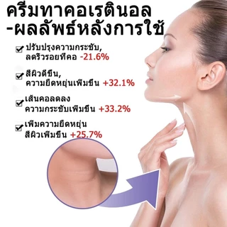 ครีมทาคอ ขาวใส กระชับผิว ลบริ้วรอยบนคอ