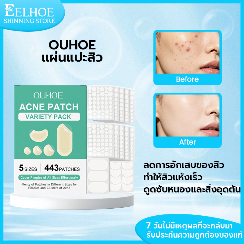 OUHOE แผ่นแปะสิว สติ๊กเกอร์บำรุงผิว ลดอาการอักเสบของสิว ดูดสิวดีมาก Acne Patch 443pcs