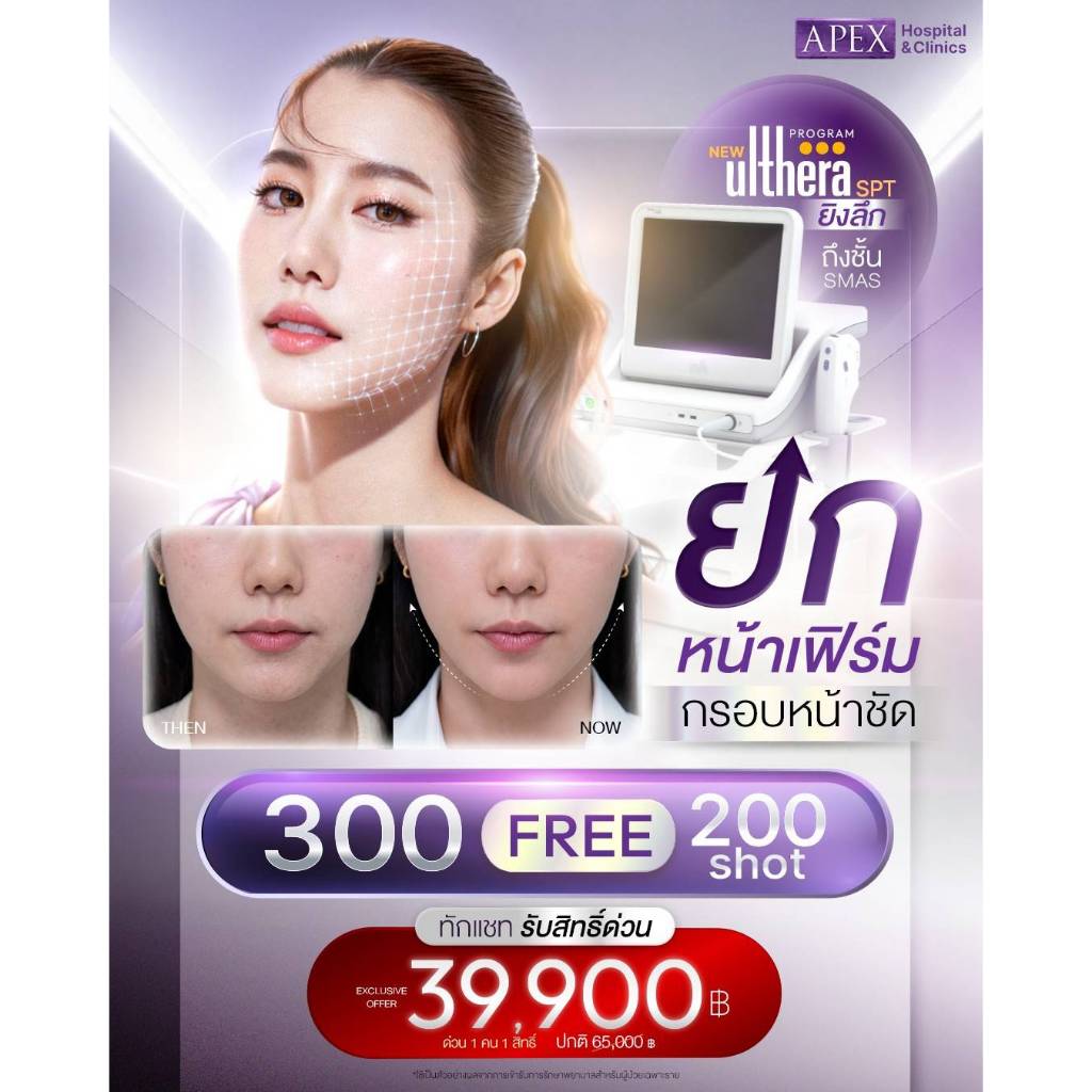 [E-Voucher] APEX ยกกระชับหน้า Ulthera spt 300 แถมฟรี 200 shot ได้ 500 shot ราคา 39,900 ปกติ 59,000 1