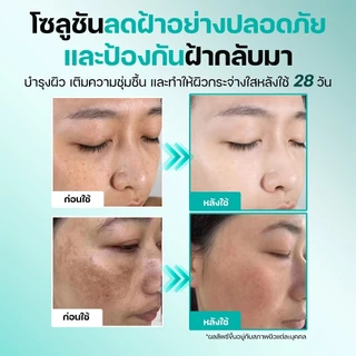 SEYOUL Advanced Serum 50ml เซรั่มลดเลือนฝ้า กระ จุดด่างดำ 10% Niacinamide + Arbutin เติมความชุ่มชื้น