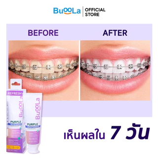 Buoola Purple Whitening Gel Toothpaste ยาสีฟันม่วง ช่วยลดคราบพลัค ลมหายใจสดชื่น ใช้ทุกวันได้ปลอดภัย