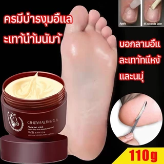 ครีมทาส้นทาแตก ครีมทาเท้าแตก ที่ขัดเท้าแตก ครีมบำรุงเท้า เท้าแตก ดูแลมือ ขัดผิวหนัง แห้ง หยาบ หนัง