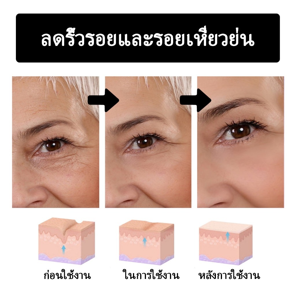 Retinol cream 20g นำเข้าจากญี่ปุ่นและเกาหลี รูปที่ 5